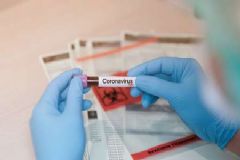 Hospital Unimed registra a 2ª morte por coronavírus e o HC tem 18 casos confirmados 