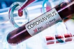 Paciente de 95 anos que saiu de casa de repouso é 24º caso de morte por coronavírus no HC