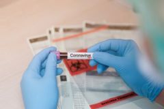 Botucatu chega a mais de 270 casos de pacientes recuperados após infecção pelo novo coronavírus