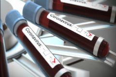 Mais duas mortes por coronavírus são registradas em Botucatu que agora soma 17 casos