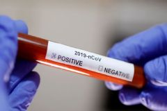 Homem de 47 anos é o mais recente caso de morte por coronavírus ocorrida no HC de Botucatu