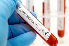 Mulher de 78 anos de idade é a 20º vítima de morte por coronavírus registrada em Botucatu