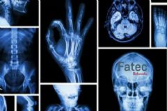 Curso Superior de Tecnologia em Radiologia da Fatec de Botucatu renova parceria com a Unesp
