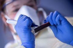Paciente de 42 anos é a 42ª morte ocasionada por covid-19 em Botucatu desde o início da pandemia