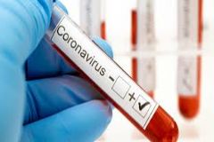 Hospital das Clínicas registra mais uma morte de morador de Botucatu infectado por coronavírus