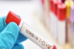 Com dois recentes casos, Botucatu eleva para 126 mortes ocasionadas por  infecção de coronavírus