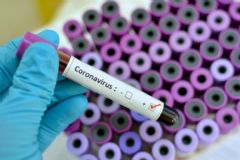 Tudo o que você precisa saber sobre o coronavírus no Brasil e como se prevenir