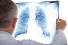 Médicas do Hospital das Clínicas alertam sobre doenças respiratórias nas crianças durante o inverno