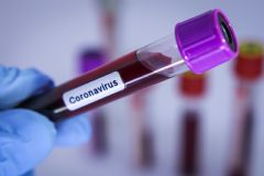 Hospital das Clínicas da Unesp de Botucatu aponta cinco internados com suspeita de coronavírus