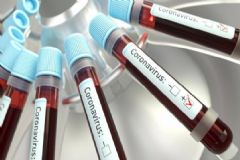 Novo boletim oficial do HC sobre suspeita de coronavírus aponta duas mortes e vários internados
