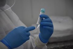 Prefeitura de Botucatu inicia levantamento com testagem de coronavírus na população