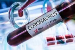 Homem de 80 anos é o quinto caso de morte de morador de Botucatu no HC vítima do coronavírus  